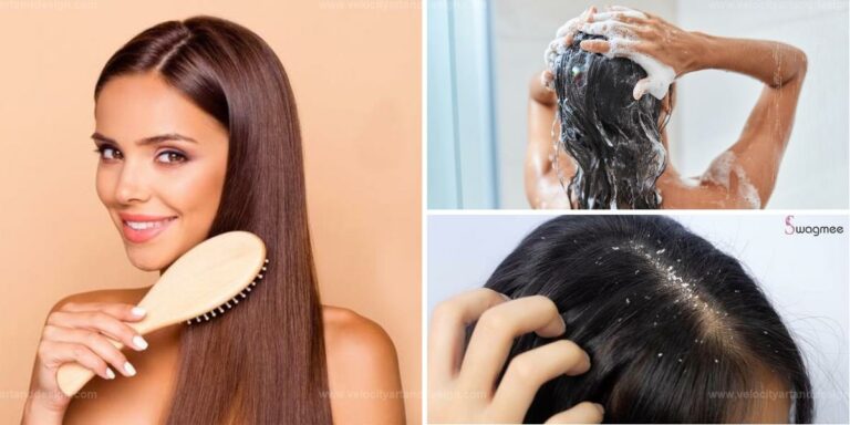 Best DIY Dandruff Remedies for a Healthier Scalp