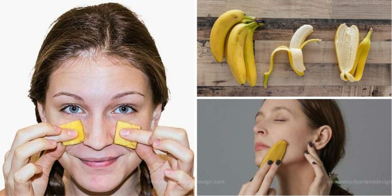 Best Banana Peel Remedy For Spotless Skin